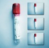 3ml blood collection pain tube